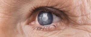 health आंखों को नुकसान पहुंचता है।